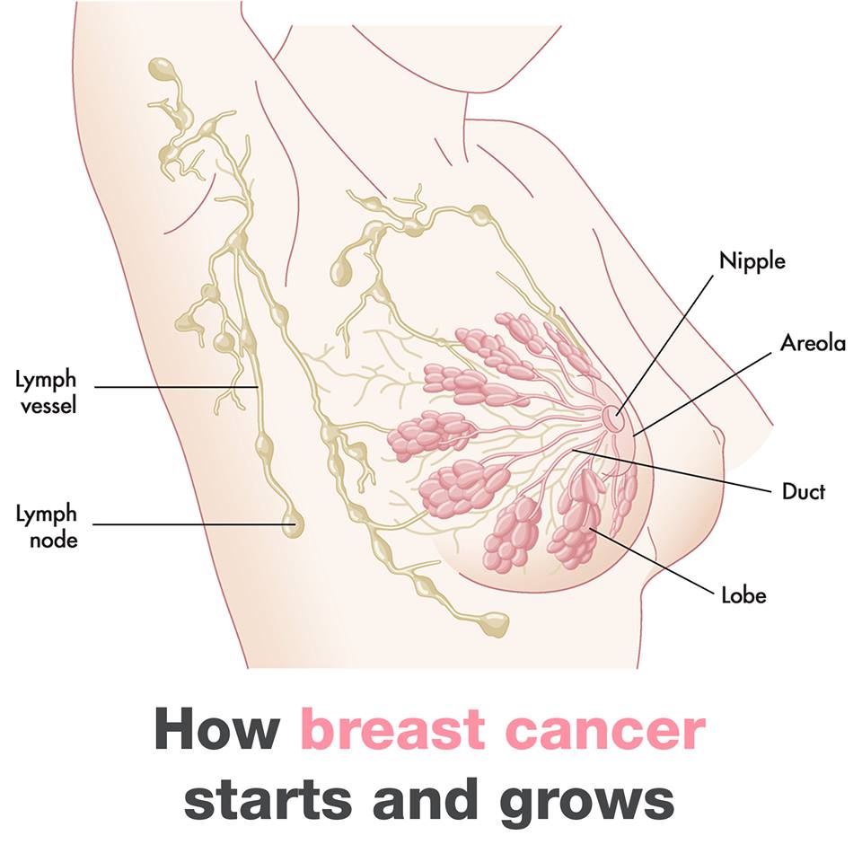 How Breast cancer Starts & Grows