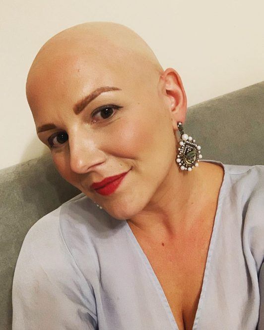 Jo Tucker is a ' baldmothertucker ' & raising Alopecia Awareness