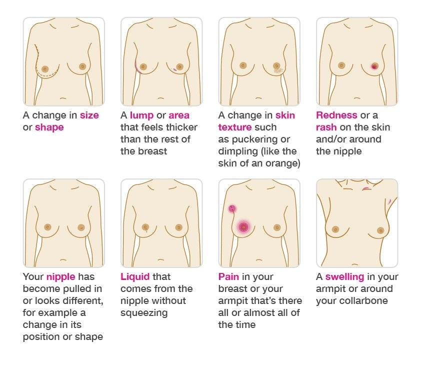 Signs, Symtoms of Breast Cancer